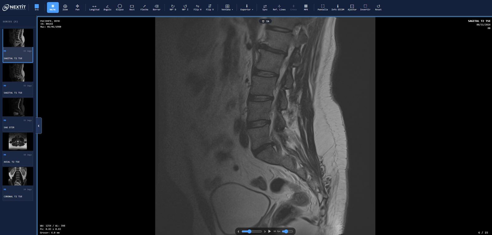 Visor DICOM de NextIT: resonancia de columna, vista 1x1